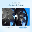 21세기 크리닝 | 부산 강서구 명지동 공기청정기 분해청소 스마일케어에 맡기세요!