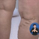 스키니짐 이미지