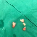 사랑니를부탁해구강악안면외과치과의원 | 압구정 사랑니를부탁해구강악안면외과치과의원 위치 가는길