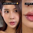 신사멜로우피부과의원 네이버블로그