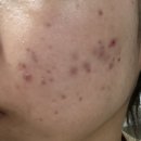 역삼생생약국 이미지