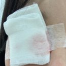잠실SU연세안과의원 | 【6월】지옥의 잔병치레 모음zip(다래끼3종세트 + 무릎 까진 상처 복구 + 잠실su연세안과후기)