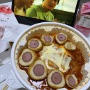 세준검진의원 | 라섹 일기 🤓