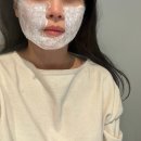 바로서면병원 | 서면피부과 추천 서면레이저리프팅 슈링크유니버스 솔직 후기