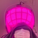 털찐친구들 | 비듬공주 모여라 웰킨두피탈모센터 천안 신부점에서 두피케어 받고 온 찐 후기