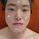 나날스킨 - 강남구 강남대로118길 26 | 신논현 피부관리 나날스킨 트러블 좁쌀여드름 악건성 관리 후기