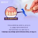 헤리치과의원 네이버블로그