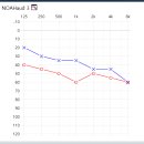 독일시그니아보청기 이미지