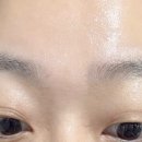 주름집 | 주름패치 추천｜리프넬 미간패치 사용후기, 집에서도 간편한 주름케어