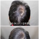동명 남성 헤어 네이버블로그