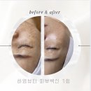 하영피부관리 이미지
