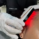 탈모왕 광주점 | 광주두피케어 도라랩에서 산후탈모 정밀검사 받고 모리바이브 생장술 한 후기