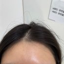 얼루어 - 안동시 경북대로 438-1 | [경남/진주시] 얼루어왁싱 후기(헤어라인,이마)