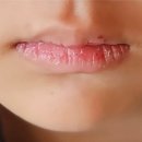 일화약국 | 약국 추천템 립연고 큐립 내돈내산 리뷰