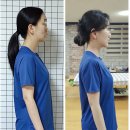 다나께바른몸바른자세 | 구미 웨딩 준비 자세관리｜구미익상견갑 라운드숄더 내돈내산 다나께 바른몸 바른자세 후기