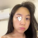 빛으로 그린 세상 | 상인동 피부관리 킴그린스킨앤바디 홍조 진정관리 후기
