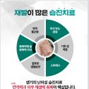 안심한의원 네이버블로그