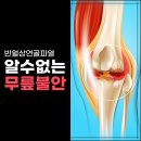 서울신정형외과의원 | 이유 없이 흔들리는 무릎, 반월상연골 손상? <음성 대소면 서울신정형외과>