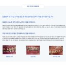 예스안치과의원 네이버블로그