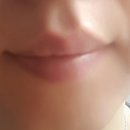 온메디케어 이미지