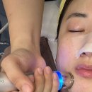 세광메디칼 | 수원 금곡동 피부관리 “늘그린스킨” 스킨플래닝 만족 후기