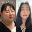 에스테틱J 이미지