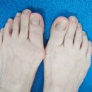 풋스올경기 | 수원무좀발톱관리 아프지않고 꼼꼼하게 풋스올 수원점 후기