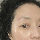 제이제이메디칼 네이버블로그