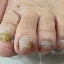 오메디칼의원 네이버블로그