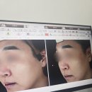 다시봄날의원 | 청주 오송 피부과 다시봄날의원 오송점 맑고 뽀얘진 피부