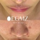 에그뮤즈 스킨스칼프 이미지