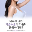 구미예스성형외과의원 | 구미 성형외과 추천, 자연스러운 가슴 수술 기준과 보형물 선택법
