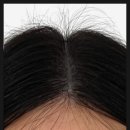로건스칼프&다이어트센터 | 영종도 두피케어 로건스칼프&다이어트센터 체험 후기