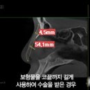 미플러스성형외과의원 네이버블로그