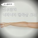 여신티켓 추천인 JOR9FFF9 노블쉐이프 팔뚝살 1회 효과, 고통 후기 (신부관리)