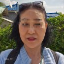 젤성형외과 강남역성형외과 미니리프팅 한달후기