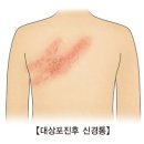 후의