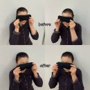 에스엔피 | 대구 탈모관리 두피관리 온미에스엔피 / 1회차 관리 후기