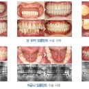 라임나무치과병원 이미지