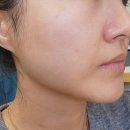 홈케어 뷰티디바이스추천 퓨라셀미인 후기