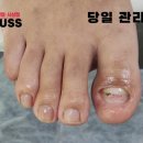 레푸스 사상점 이미지