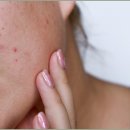 밝은침한의원 이미지