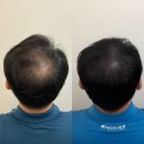 라니네세탁 이미지