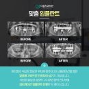 더봄치과 이미지