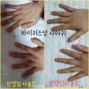 인셀덤루비대리점 | 인셀덤효과 : 인셀덤이 인생덤인 이유 ! 효과좋은 화장품추천 + 억대연봉 이루비 그녀는 누구?!