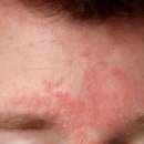 미클린의원 이미지