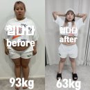 365하하병원 | [다다일상/다이어트] 서초구 초고도비만다이어트 365교대점 후관리 붓기 회복 -30kg 감량솔직후기