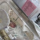 건대의료기 | 38주 0일 둘째가 태어나다 I 선택 제왕절개 후기 I 건국대학교병원 황한성 교수님 추천