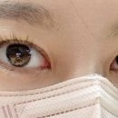 더예쁜눈