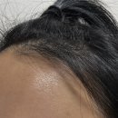 [뷰티] GS홈쇼핑 얼굴마사지기 역대급 혜택으로 만나는 뷰티디바이스 ( 쿼드쎄라 티탄 후기)